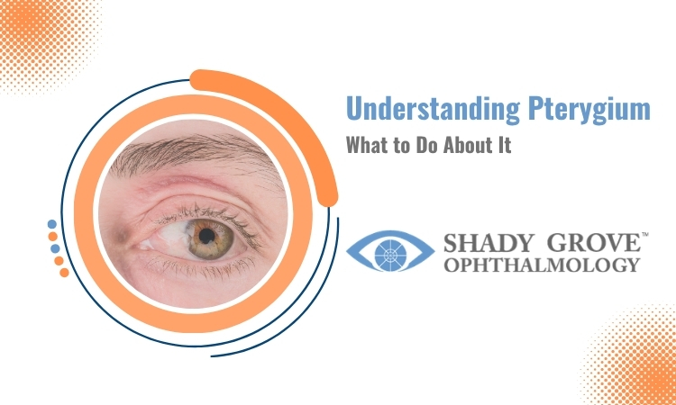 Understanding Pterygium